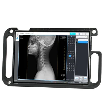 Portable display for a digital radiography system